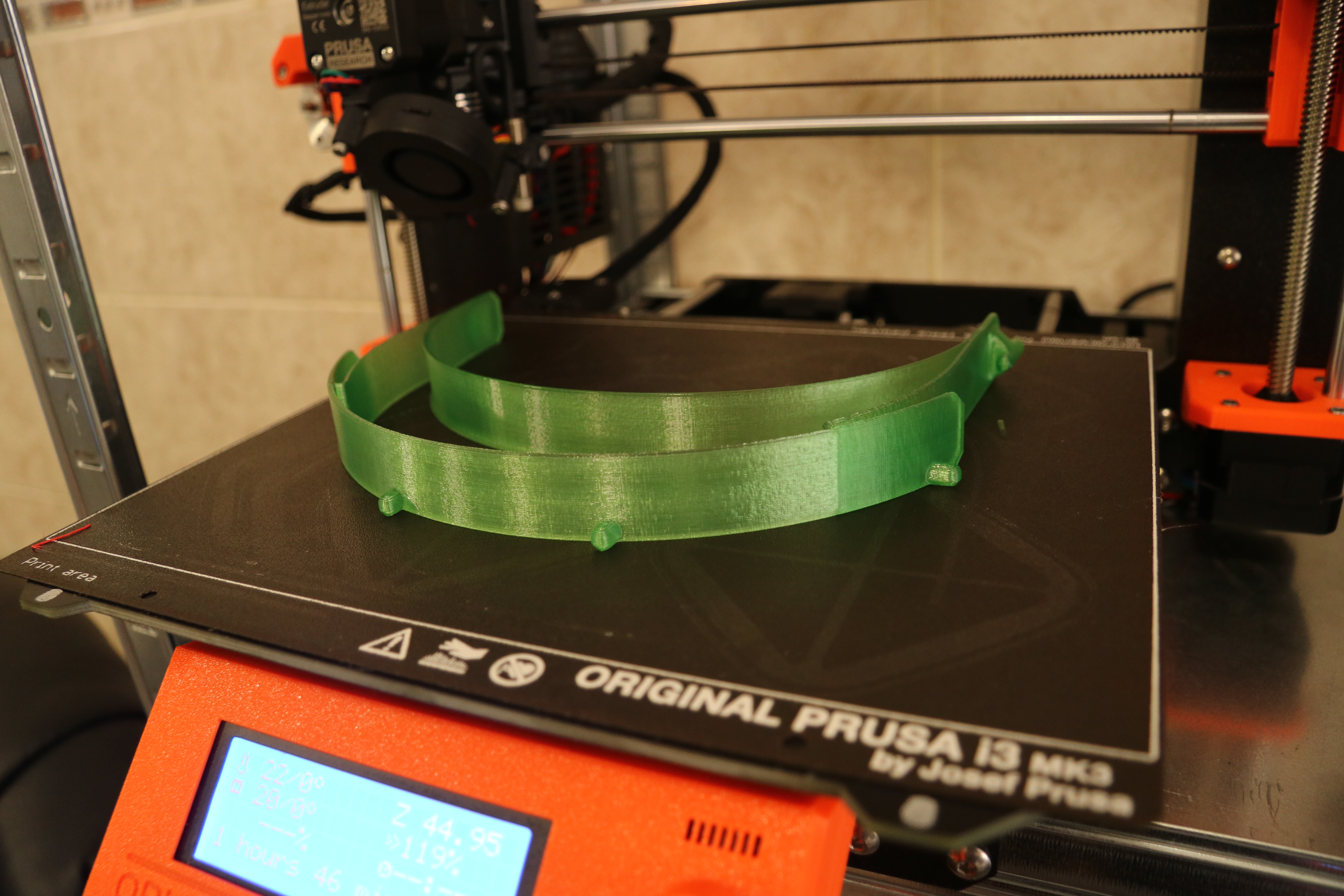 3D tisk v medicíně v ČR: případ IKEM (VR + 3D modely orgánů) a co si z toho vzít